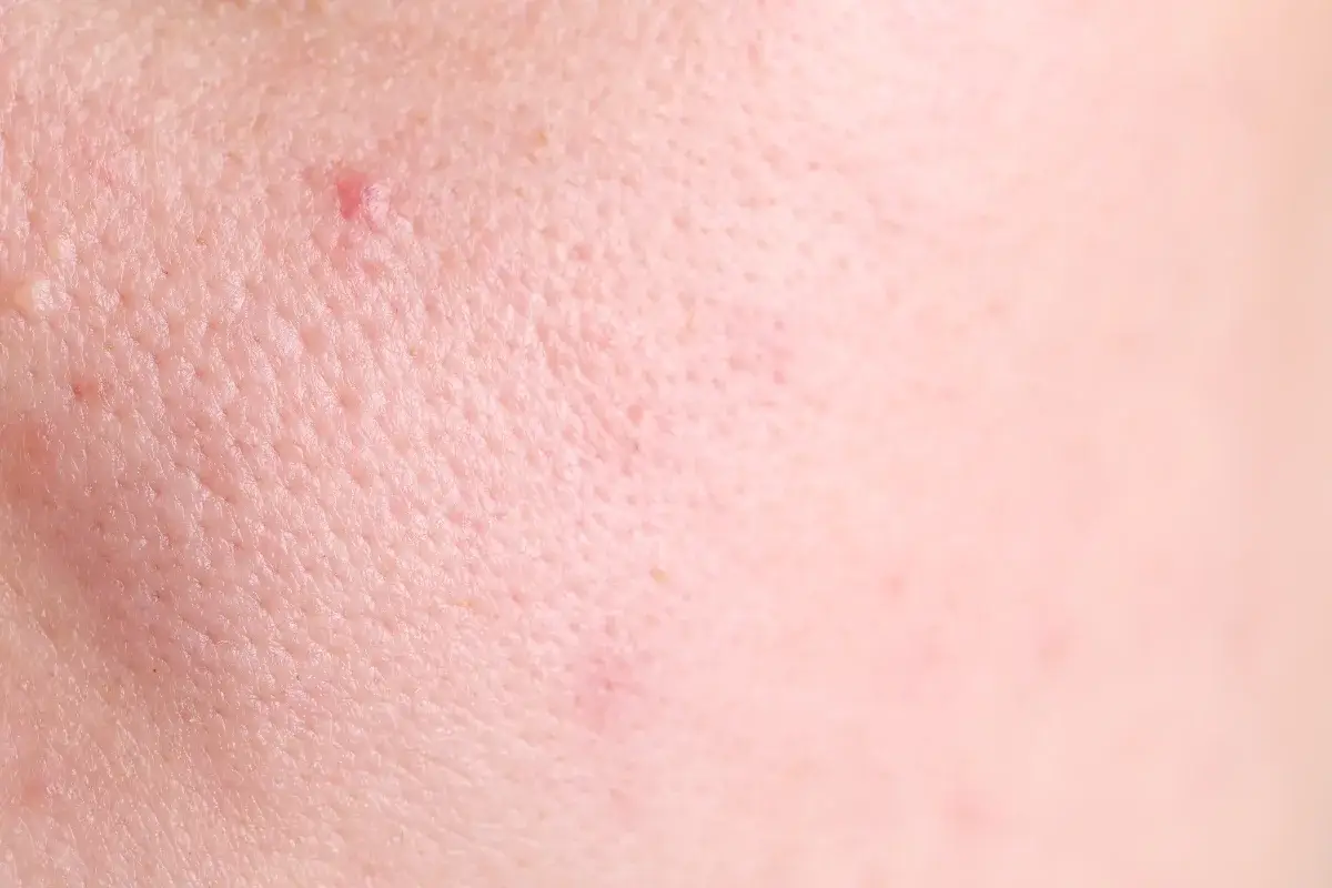 How to Minimize Open Pores | 15 Dermatologist-Backed Tips That Actually Work 1 Steam to Open Pores