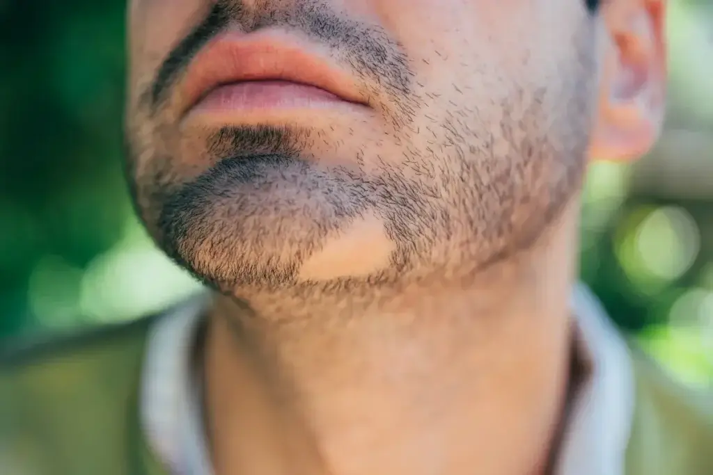 How to Make Beard Growth Oils at Home with 10 Easy DIY Recipes 5 How to Grow Beard Faster in 7 Days